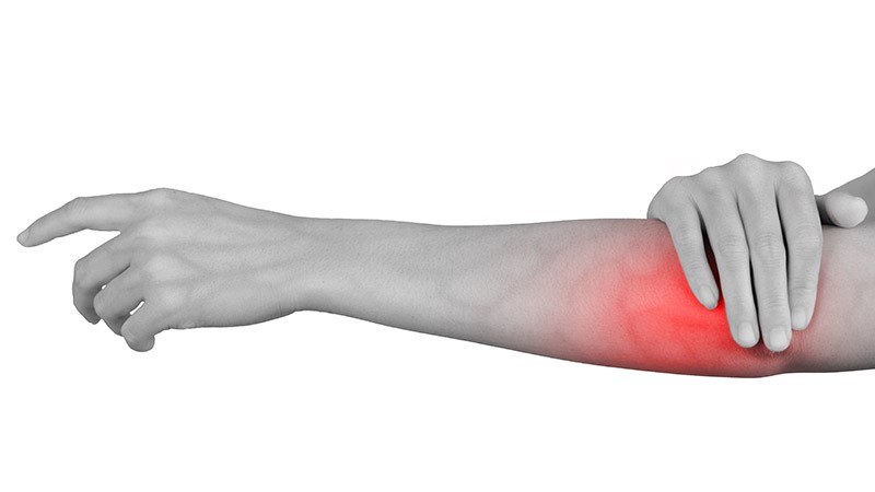Tennis Elbow (Lateral Epicondylitis), What is it?